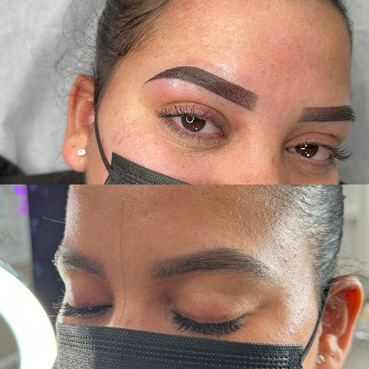 BROWS CORRECTION